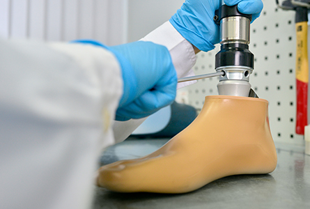 Improve Your Patient Retention with Orthotics and Prosthetics Marketing